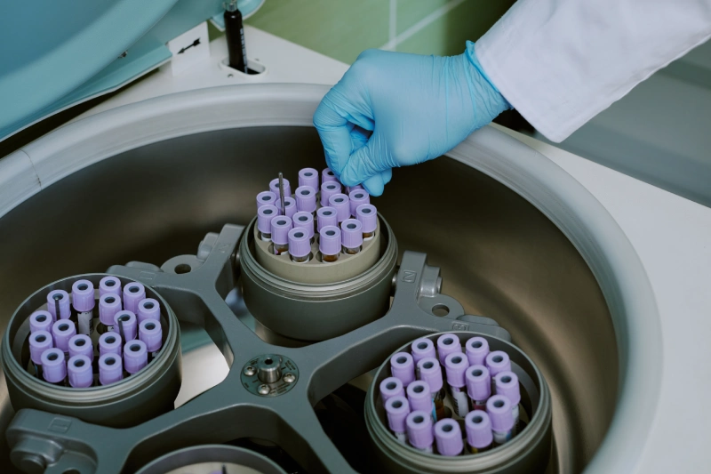blood samples